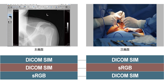 基于DICOM SIM模式下的画外画模式